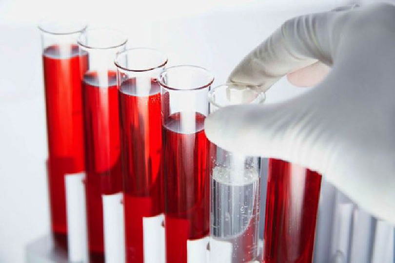 Как правильно сдавать кровь на гормоны?
